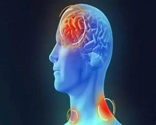 Com morte de mulher de 37 anos, total de óbitos por meningite sobe para três em Pernambuco