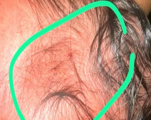 Recém-nascido é atingido de raspão por bala perdida dentro de hospital no Recife