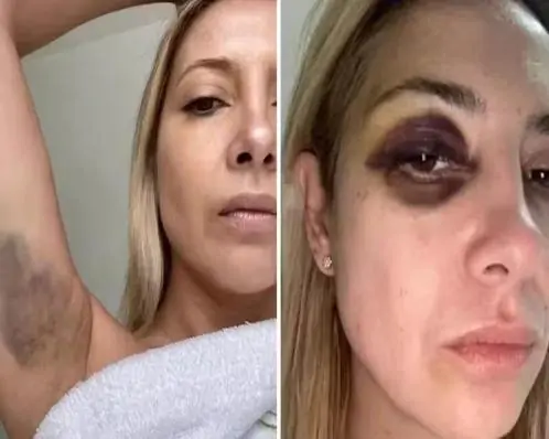 Justiça espanhola quer extrair vídeos e fotos do celular da ex-mulher de Alberto Fernández