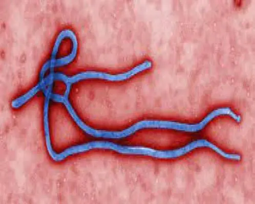 Ebola: Teste de paciente internado em São Paulo dá negativo