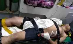 Professor tem dedo e orelha arrancados no interior de Pernambuco