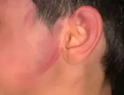 Mãe é detida por espancar filho de 6 anos dentro de casa em Pombos, na Zona da Mata Sul