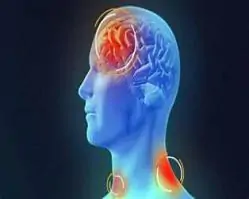 Com morte de mulher de 37 anos, total de óbitos por meningite sobe para três em Pernambuco